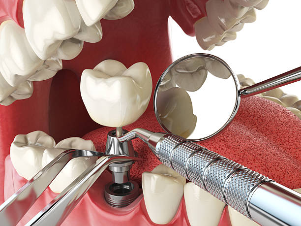 Best Emergency Treatment for Dental Infections or Abscesses in Chippewa Falls, WI